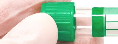 Plasma-Flaschen-Einfrierung