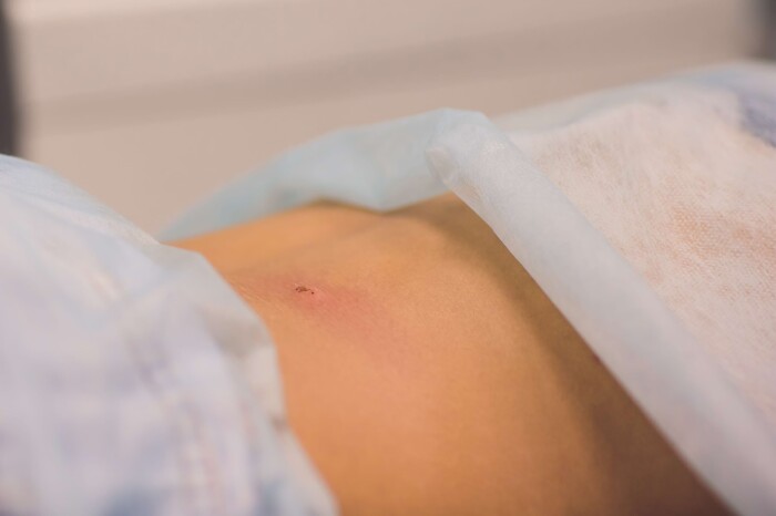 Gezielte K&auml;ltetherapie bei Entz&uuml;ndungen