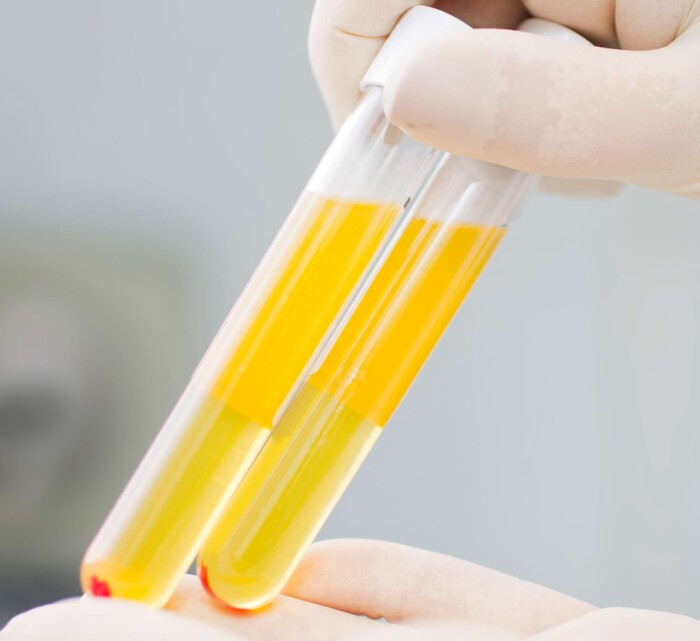 Blutplasma im Reagenzglas