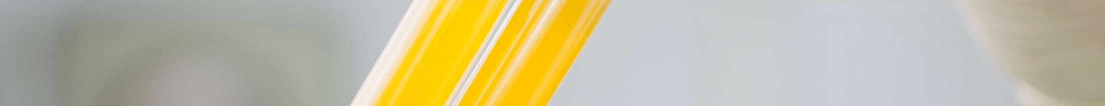 Blutplasma in Reagenzgl&auml;sern